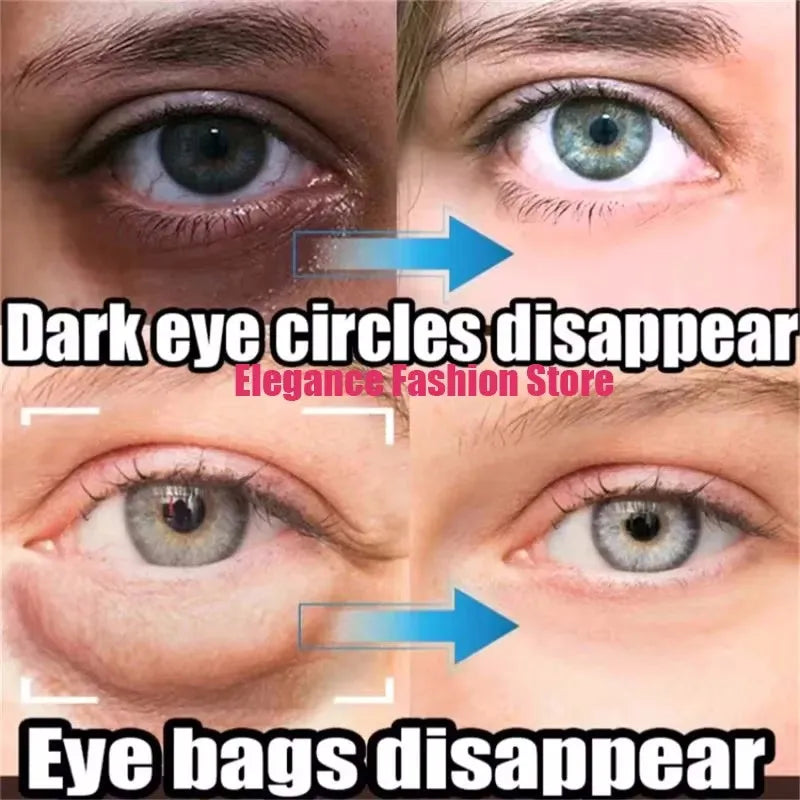 Instant Eye Bag Remove Eye Cream Anti Fat Particles Dark Circles Puffiness Fade Fine Lines Lift Brighten Korean Beauty Eye Care هذا المنتج عبارة عن كريم للعناية بمنطقة محيط العينين يعتمد على التقنية الكورية للعناية بالبشرة (Korean Beauty)، ويستهدف عدة مشا