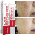 Whitening Freckles Face Cream Removal Melasma Dark Spots Corrector Lighten Melanin Pigmentation Brighten Anti-Aging Beauty Careصحح البقع الداكنة (Dark Spots Corrector): يقلل من مظهر البقع البنية والداكنة وآثار الحبوب.
تقليل صبغة الميلانين (Lighten Melani