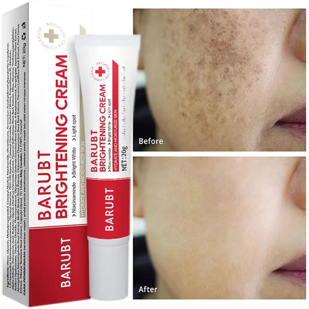 Whitening Freckles Face Cream Removal Melasma Dark Spots Corrector Lighten Melanin Pigmentation Brighten Anti-Aging Beauty Careصحح البقع الداكنة (Dark Spots Corrector): يقلل من مظهر البقع البنية والداكنة وآثار الحبوب.
تقليل صبغة الميلانين (Lighten Melani