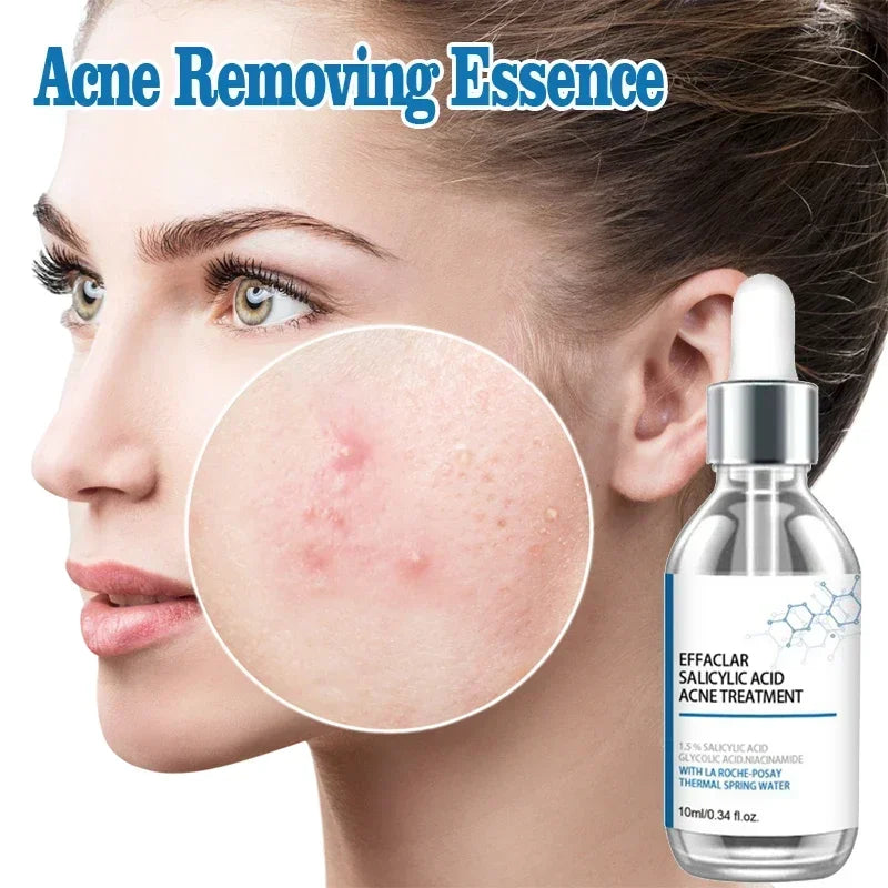 2026 Salicylic Acid  Solution Essence Shrink pores and Acne Spot Removing Shrink Pores Oil-Control Brighten Face Skin Makeup