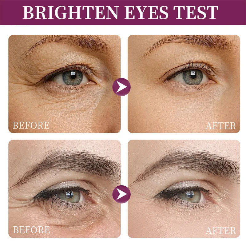 Instant Eye Bag Remove Eye Cream Anti Fat Particles Dark Circles Puffiness Fade Fine Lines Lift Brighten Korean Beauty Eye Care هذا المنتج عبارة عن كريم للعناية بمنطقة محيط العينين يعتمد على التقنية الكورية للعناية بالبشرة (Korean Beauty)، ويستهدف عدة مشا