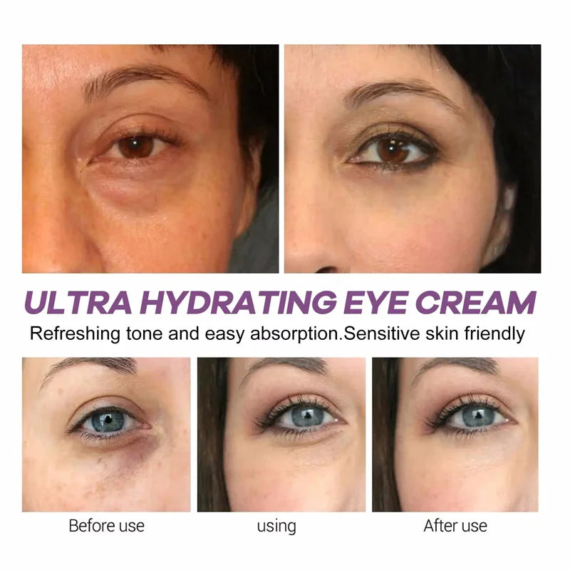 Instant Eye Bag Remove Eye Cream Anti Fat Particles Dark Circles Puffiness Fade Fine Lines Lift Brighten Korean Beauty Eye Care هذا المنتج عبارة عن كريم للعناية بمنطقة محيط العينين يعتمد على التقنية الكورية للعناية بالبشرة (Korean Beauty)، ويستهدف عدة مشا