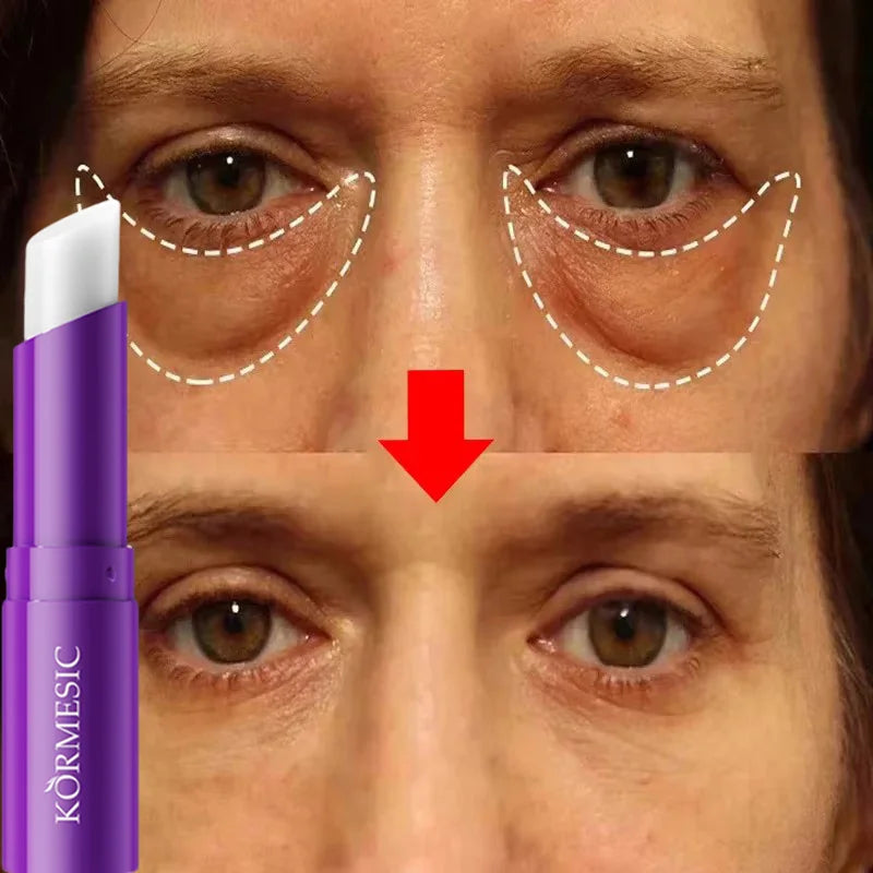 Instant Eye Bag Remove Eye Cream Anti Fat Particles Dark Circles Puffiness Fade Fine Lines Lift Brighten Korean Beauty Eye Care هذا المنتج عبارة عن كريم للعناية بمنطقة محيط العينين يعتمد على التقنية الكورية للعناية بالبشرة (Korean Beauty)، ويستهدف عدة مشا
