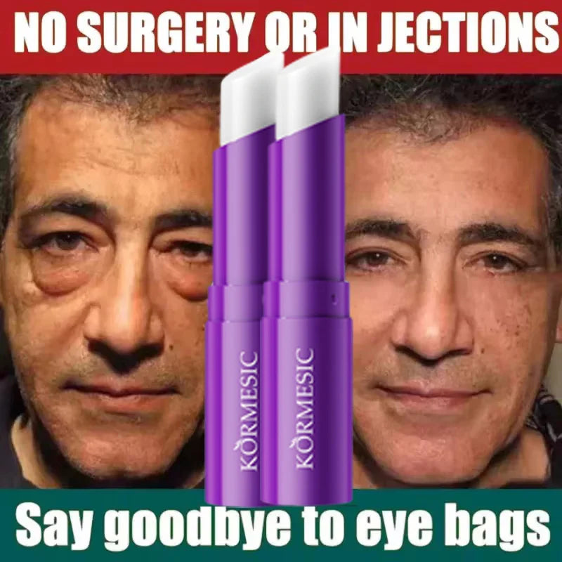 Instant Eye Bag Remove Eye Cream Anti Fat Particles Dark Circles Puffiness Fade Fine Lines Lift Brighten Korean Beauty Eye Care هذا المنتج عبارة عن كريم للعناية بمنطقة محيط العينين يعتمد على التقنية الكورية للعناية بالبشرة (Korean Beauty)، ويستهدف عدة مشا