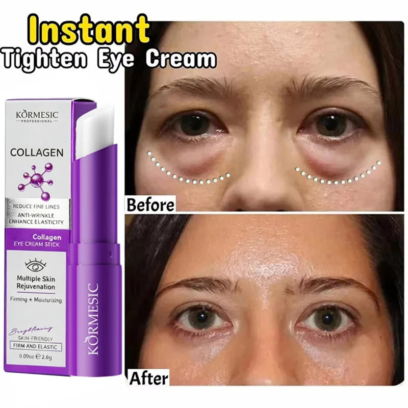 Instant Eye Bag Remove Eye Cream Anti Fat Particles Dark Circles Puffiness Fade Fine Lines Lift Brighten Korean Beauty Eye Care هذا المنتج عبارة عن كريم للعناية بمنطقة محيط العينين يعتمد على التقنية الكورية للعناية بالبشرة (Korean Beauty)، ويستهدف عدة مشا